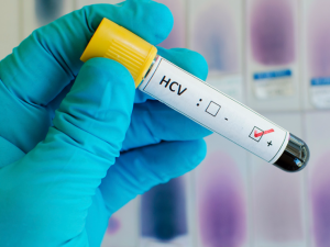 После проведения вирусной нагрузки врачи могут спрогнозировать активность вируса гепатита С в организме человека