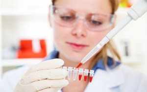 Для исследования уровня эозинофилов нужно сдать общий анализ крови