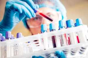 Гемолитический анализ крови относится к самым распространенным лабораторным исследованиям
