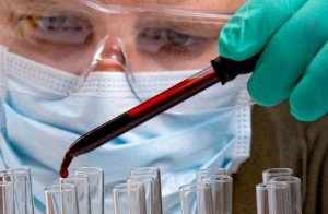 Анализ крови на РМП - это лабораторный метод диагностики сифилиса 