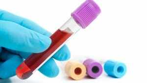Анализ крови на иммуноглобулин Е позволяет выявить заболевания аллергического профиля и дифференцировать их