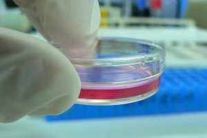 Бакпосев крови проводится с целью определения бактерий в крови, что невозможно при обычном лабораторном обследовании этого материала