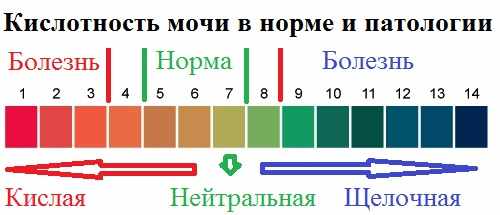 Кислотность мочи в норме и патологии