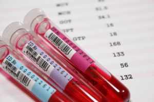 Анализы крови в пробирках