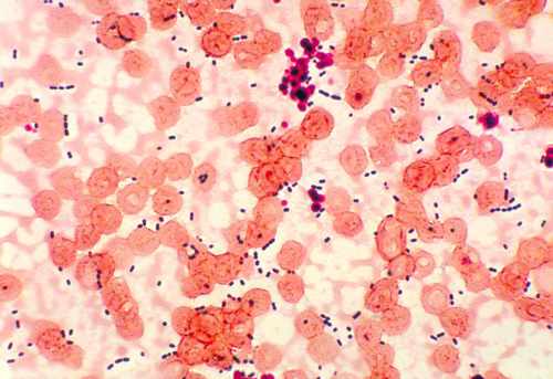 Enterococcus faecalis в крови