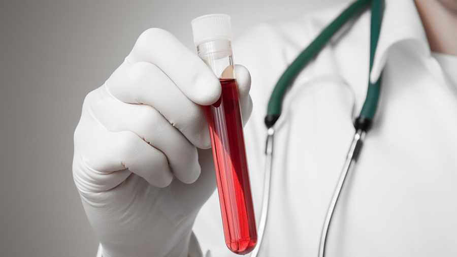 Анализ крови в пробирке