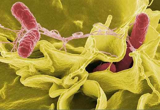 Enterococcus faecalis под микроскопом