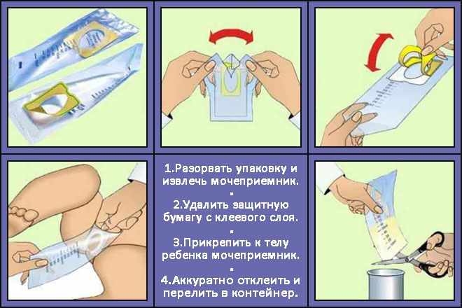 Мочеприемник для грудных детей