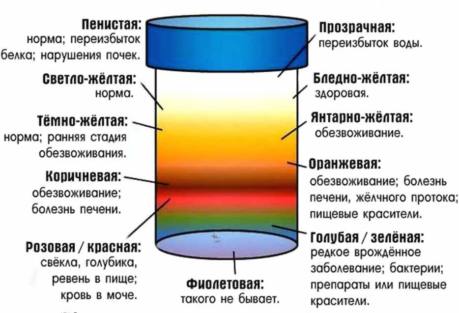 Цветовая палитра мочи