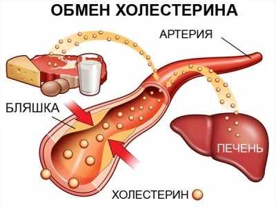 повышенный холестерин