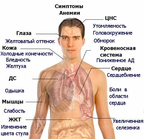 Железодефицитная анемия