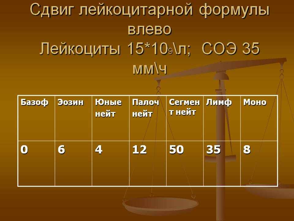 Сдвиг лейкоцитарной формулы влево