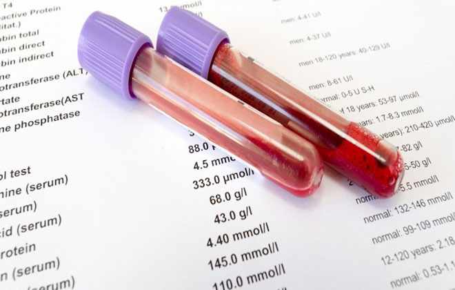 биохимический анализы крови