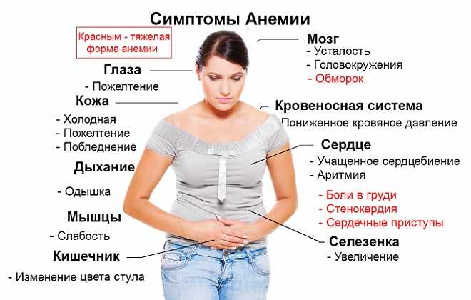 Симптомы недуга и тяжелая форма