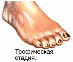 Трофическая стадия