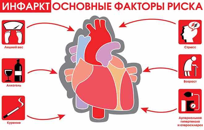 Причины инфаркта