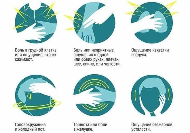 Типичные боли в сердце после инфаркта миокарда