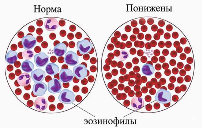 Нормальные показатели и понижение