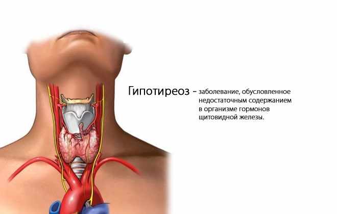Признаки гипотиреоза видны без анализа крови на гормоны