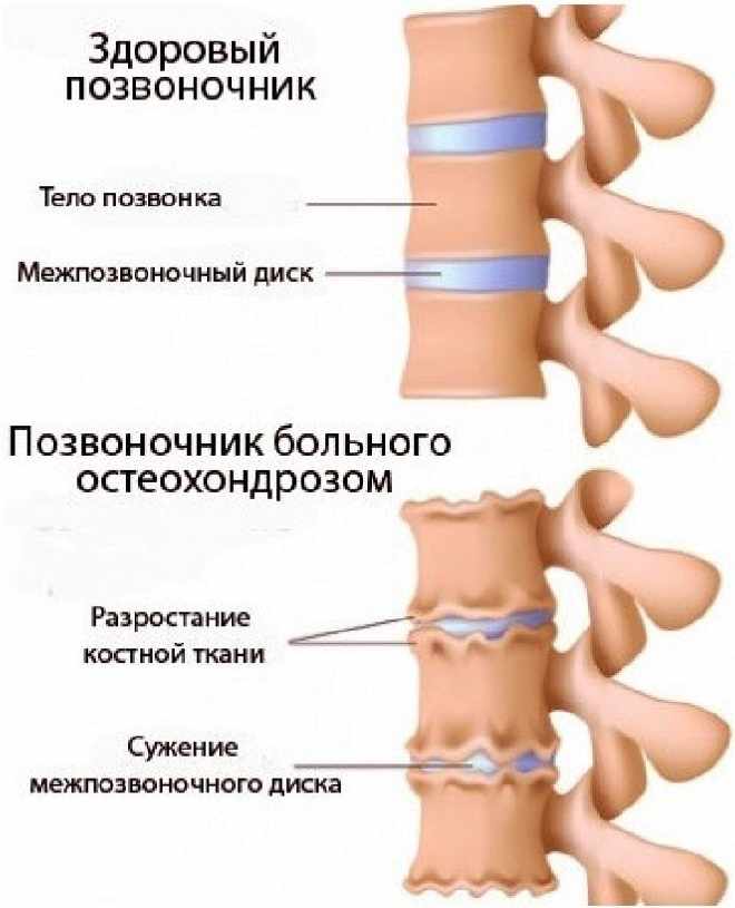 Выявление заболевания на ранних стадиях