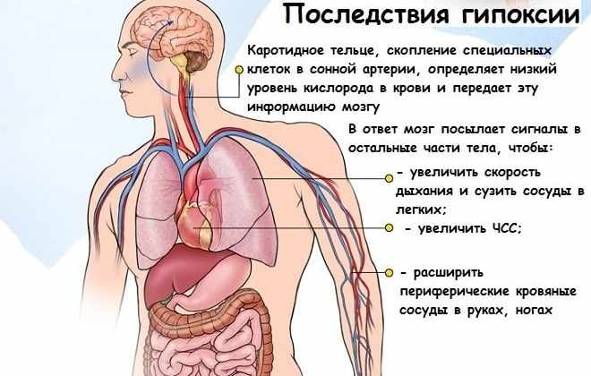 Что происходит с человеком при кислородном голодании