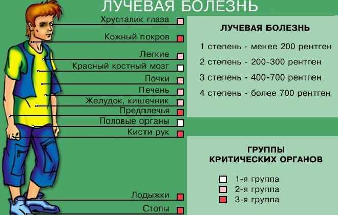 Схема проявления заболевания