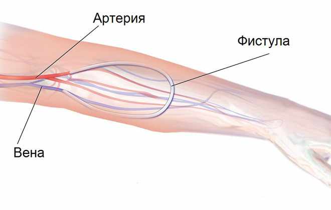Патология сосудов
