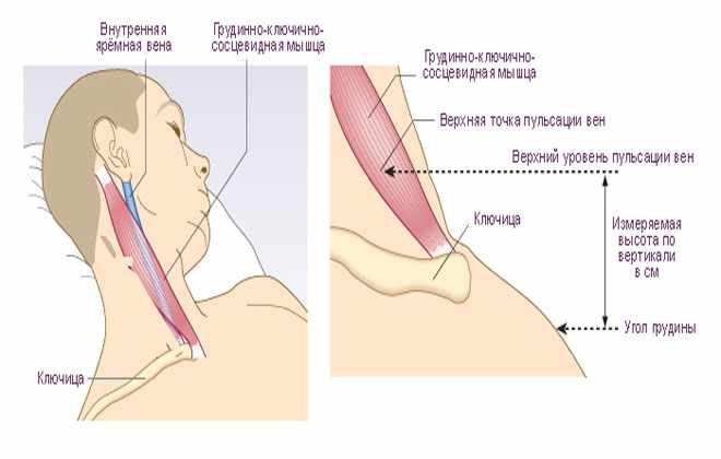 Внутренняя Яремная Вена