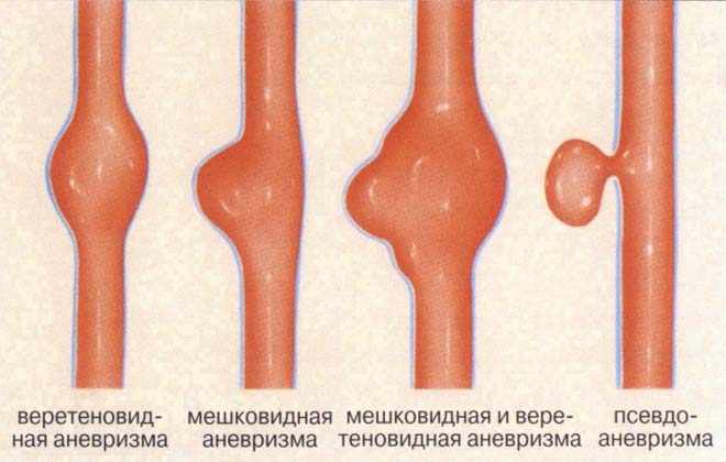 Развитие заболевания