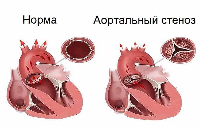 Визуальное определение заболевания